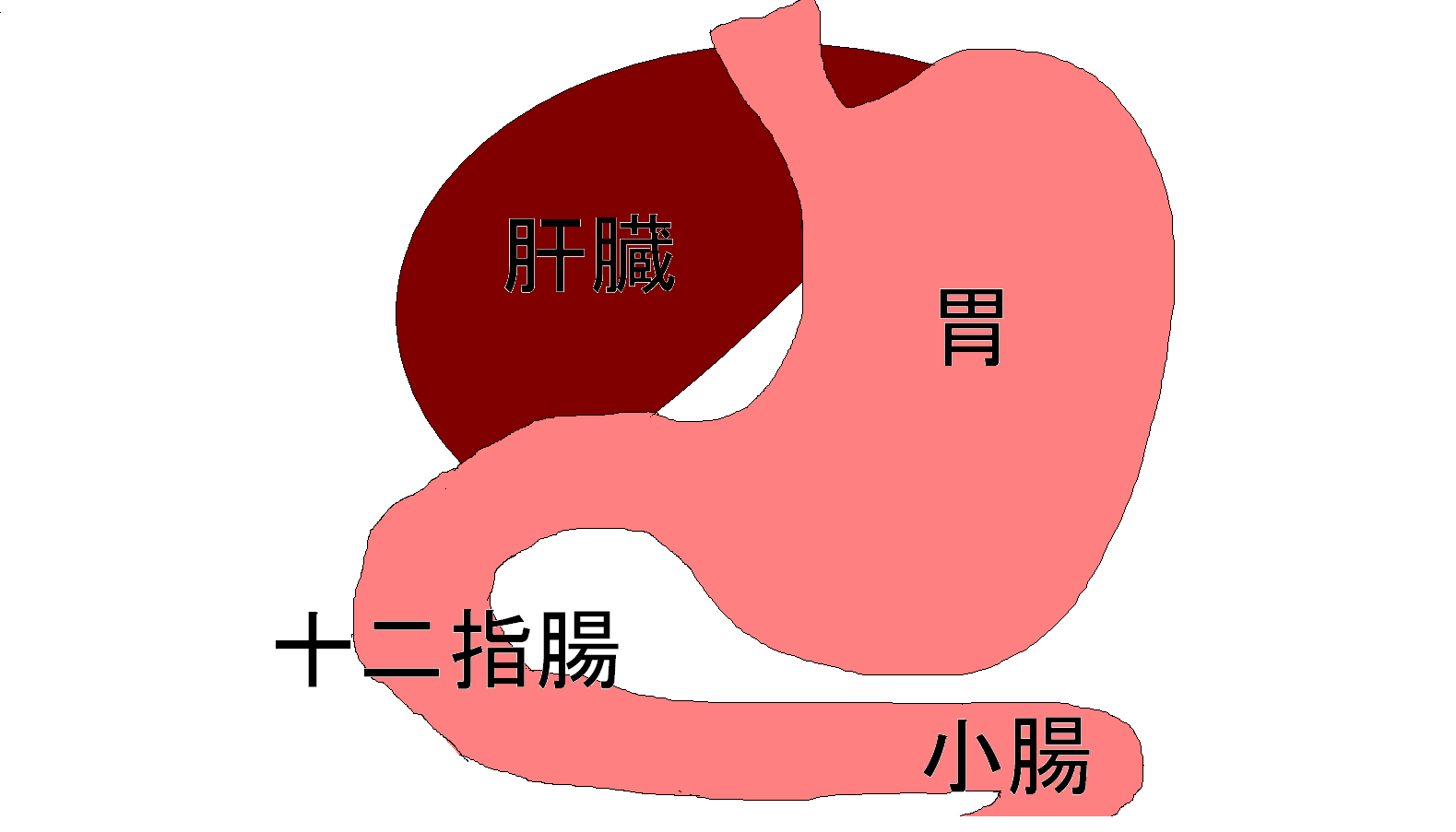 body
